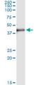 MAD2L1 Binding Protein antibody, H00009587-M13, Novus Biologicals, Immunoprecipitation image 