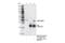 Dual Specificity Phosphatase 1 antibody, 48625S, Cell Signaling Technology, Immunoprecipitation image 