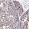 Plakophilin 2 antibody, NBP2-58748, Novus Biologicals, Immunohistochemistry paraffin image 