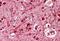 Achaete-Scute Family BHLH Transcription Factor 3 antibody, NBP1-68871, Novus Biologicals, Immunohistochemistry paraffin image 