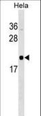 RWD Domain Containing 1 antibody, LS-C158909, Lifespan Biosciences, Western Blot image 