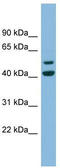 Ankyrin repeat and MYND domain-containing protein 2 antibody, TA344796, Origene, Western Blot image 