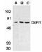 TNF Receptor Superfamily Member 10c antibody, PA1-30699, Invitrogen Antibodies, Western Blot image 