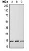 Regulator Of G Protein Signaling 17 antibody, LS-C353822, Lifespan Biosciences, Western Blot image 