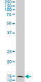 Fission, Mitochondrial 1 antibody, LS-C105139, Lifespan Biosciences, Western Blot image 