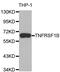 TNF Receptor Superfamily Member 1B antibody, MBS125453, MyBioSource, Western Blot image 