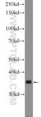 Cytochrome C Oxidase Assembly Factor COX18 antibody, 18071-1-AP, Proteintech Group, Western Blot image 