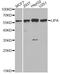Lipase A, Lysosomal Acid Type antibody, A6385, ABclonal Technology, Western Blot image 