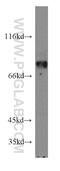 Amyloid Beta Precursor Protein Binding Family B Member 1 antibody, 12526-1-AP, Proteintech Group, Western Blot image 