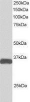 STE20 Related Adaptor Beta antibody, NB100-1181, Novus Biologicals, Western Blot image 
