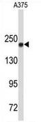DNA Topoisomerase II Alpha antibody, AP54331PU-N, Origene, Western Blot image 