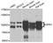 OPA1 Mitochondrial Dynamin Like GTPase antibody, A9833, ABclonal Technology, Western Blot image 