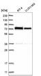 Zinc Finger Protein 326 antibody, NBP2-55094, Novus Biologicals, Western Blot image 