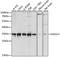 Exosome Component 3 antibody, A04146, Boster Biological Technology, Western Blot image 