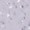 Outer Dense Fiber Of Sperm Tails 3 antibody, PA5-58709, Invitrogen Antibodies, Immunohistochemistry frozen image 