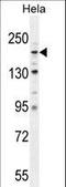 Collagen Type IV Alpha 2 Chain antibody, LS-B15653, Lifespan Biosciences, Western Blot image 