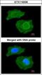 Fatty Acid Binding Protein 4 antibody, GTX116036, GeneTex, Immunofluorescence image 