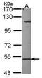 Cytochrome P450 Family 27 Subfamily A Member 1 antibody, PA5-29903, Invitrogen Antibodies, Western Blot image 