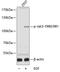Janus Kinase 3 antibody, A02598Y980, Boster Biological Technology, Western Blot image 