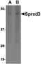 Sprouty Related EVH1 Domain Containing 3 antibody, PA5-20626, Invitrogen Antibodies, Western Blot image 