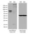Protein Phosphatase, Mg2+/Mn2+ Dependent 1D antibody, LS-C795839, Lifespan Biosciences, Western Blot image 