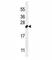 Protein C19orf84  antibody, F40018-0.4ML, NSJ Bioreagents, Western Blot image 