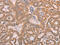 SMAD Family Member 5 antibody, CSB-PA049349, Cusabio, Immunohistochemistry paraffin image 