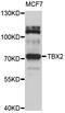 T-Box 2 antibody, abx126682, Abbexa, Western Blot image 