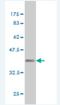 Angiopoietin Like 7 antibody, H00010218-M03-100ug, Novus Biologicals, Western Blot image 