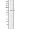 NUMB Endocytic Adaptor Protein antibody, abx217289, Abbexa, Western Blot image 