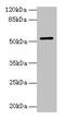 Citrate Synthase antibody, CSB-PA006031LA01HU, Cusabio, Western Blot image 