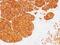 Tyrosinase antibody, NBP2-44684, Novus Biologicals, Immunohistochemistry paraffin image 