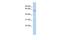 Centrosomal Protein 57 Like 1 antibody, GTX45213, GeneTex, Western Blot image 