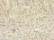 TBC1 Domain Family Member 20 antibody, A61238-100, Epigentek, Immunohistochemistry paraffin image 