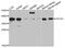 Eukaryotic Translation Initiation Factor 2 Subunit Alpha antibody, MBS125750, MyBioSource, Western Blot image 