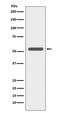 Keratin 6A antibody, M30943-1, Boster Biological Technology, Western Blot image 
