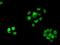 Replication Protein A2 antibody, NBP2-02182, Novus Biologicals, Immunocytochemistry image 