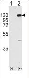 Fibroblast Growth Factor Receptor 1 antibody, 63-081, ProSci, Western Blot image 