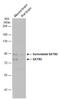 SATB Homeobox 2 antibody, GTX134105, GeneTex, Western Blot image 