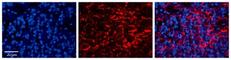 Lysosomal Protein Transmembrane 4 Beta antibody, NBP1-59416, Novus Biologicals, Immunocytochemistry image 