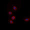Mitochondrial Pyruvate Carrier 1 antibody, LS-C356186, Lifespan Biosciences, Immunofluorescence image 