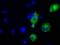 Transforming Acidic Coiled-Coil Containing Protein 3 antibody, GTX83531, GeneTex, Immunocytochemistry image 