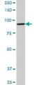 Dehydrogenase E1 And Transketolase Domain Containing 1 antibody, H00055526-B01P, Novus Biologicals, Western Blot image 