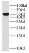 3-Oxoacid CoA-Transferase 2 antibody, FNab06051, FineTest, Western Blot image 