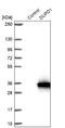Dual Specificity Phosphatase 27, Atypical antibody, NBP1-84040, Novus Biologicals, Western Blot image 