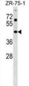 Zinc Finger And SCAN Domain Containing 31 antibody, abx029611, Abbexa, Western Blot image 