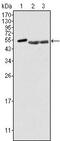 Protein Tyrosine Kinase 6 antibody, GTX83073, GeneTex, Western Blot image 