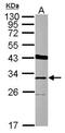 THAP Domain Containing 11 antibody, GTX124201, GeneTex, Western Blot image 
