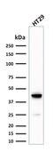 Keratin 20 antibody, GTX17981, GeneTex, Western Blot image 