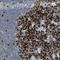 TOP2A antibody, NBP1-86928, Novus Biologicals, Immunohistochemistry frozen image 